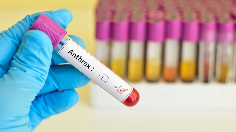First Anthrax Pneumonia Case detected in China 