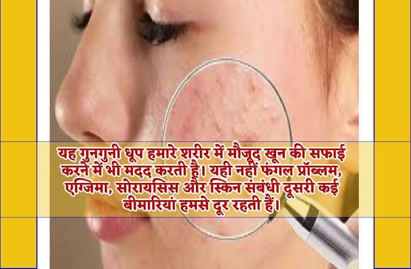 Suraj ki roshni ke fayde kar denge hairan, beauty care tips in winter