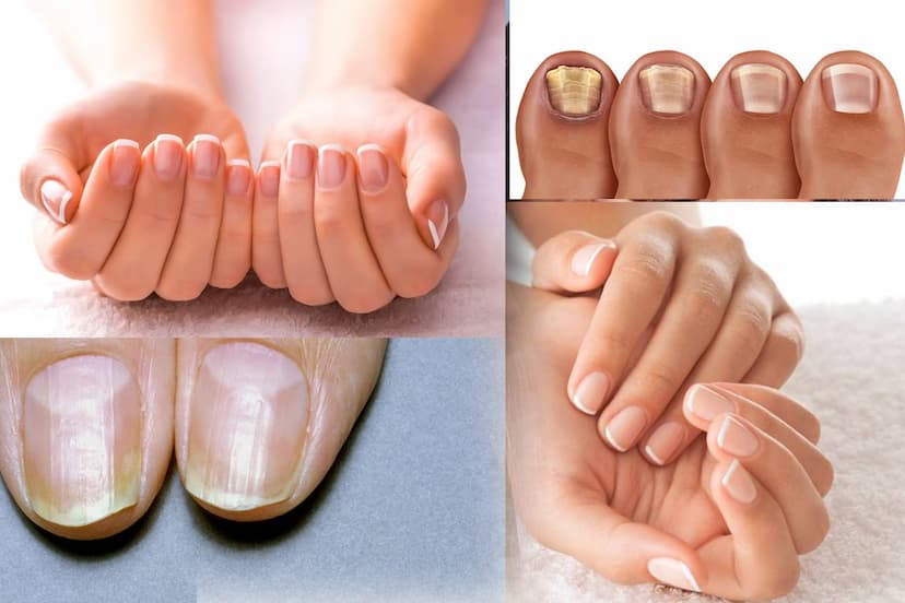 nails-say-about-your-health.jpg