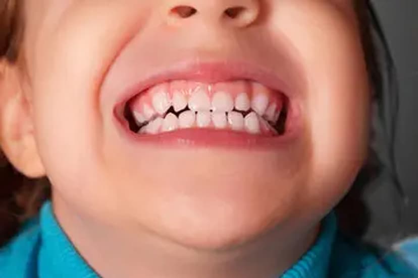 child-grinds-teeth.jpg