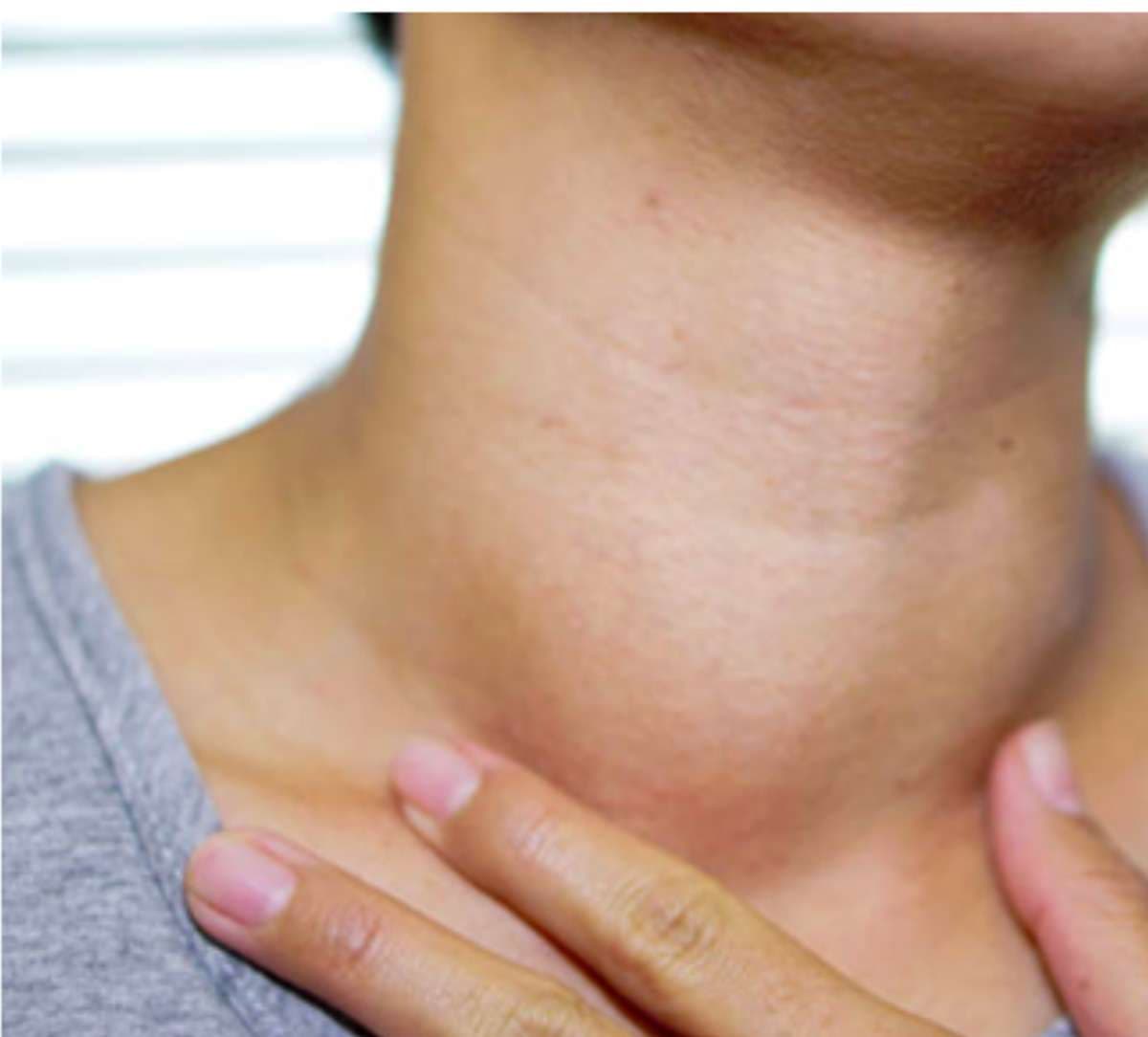 thyroid-in-women.jpg