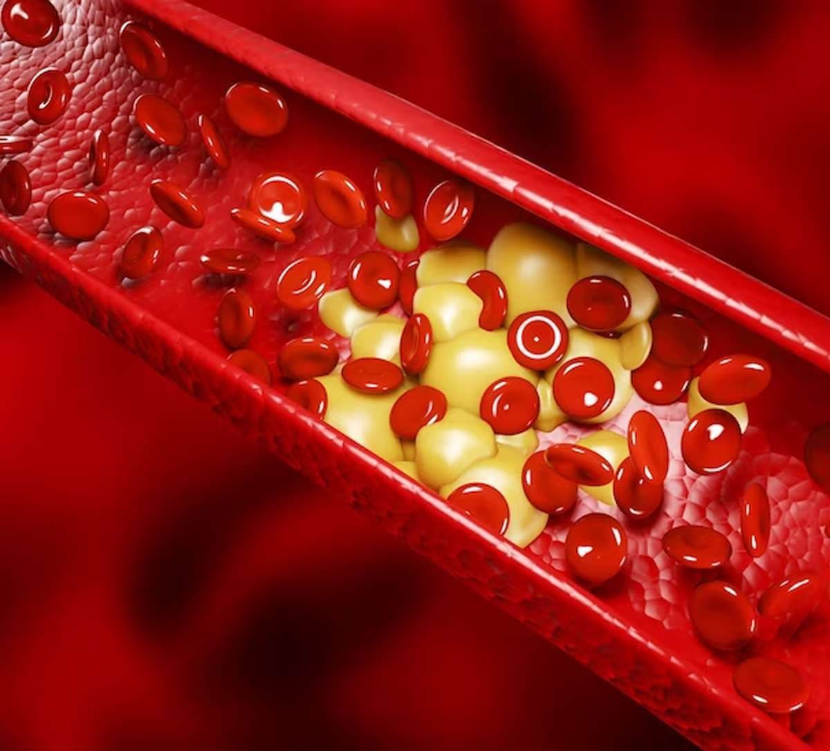 cholesterol-in-blood.jpg