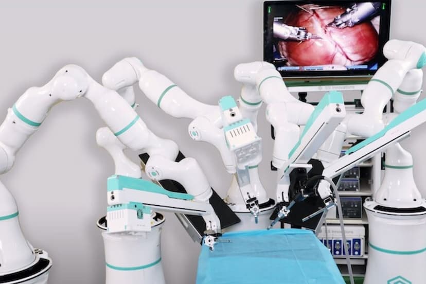 SSI Mantra Robot Performs 100th Heart Surgery