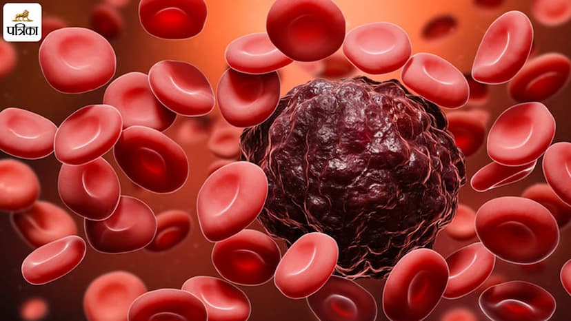 Novel Medication Offers Hope for Relapsed Blood Cancer Patients