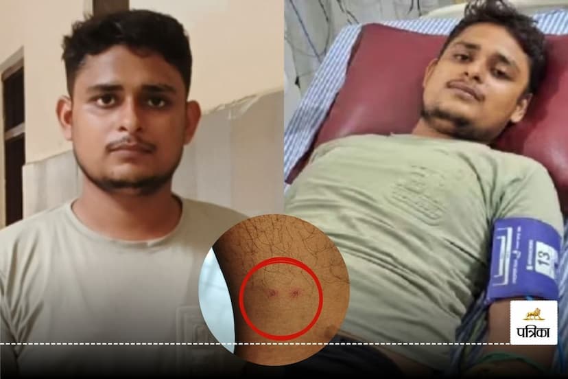 vikas dubey bitten by snake 8th time