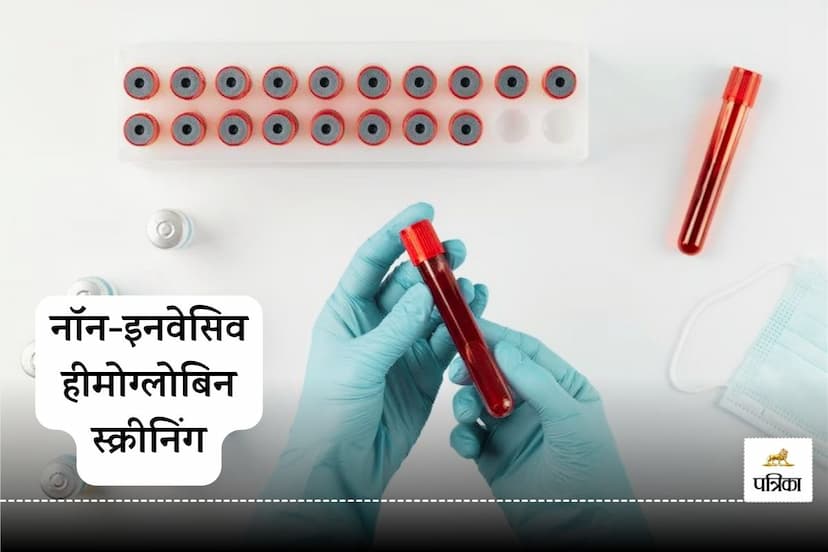 Hemoglobin test without blood sample