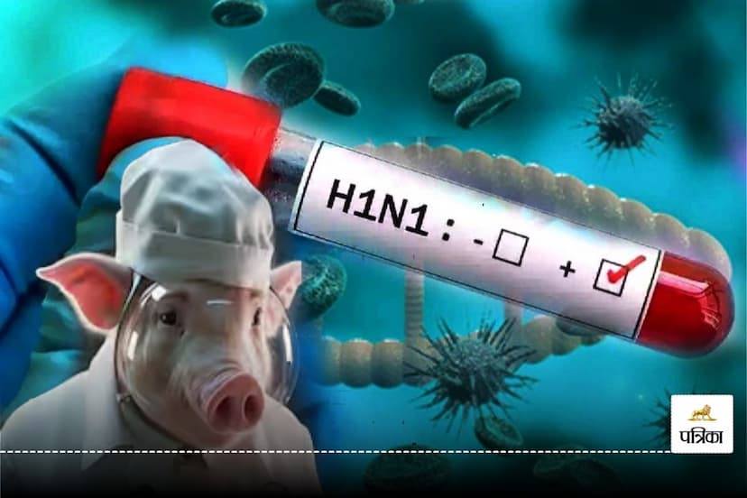 Swine Flu