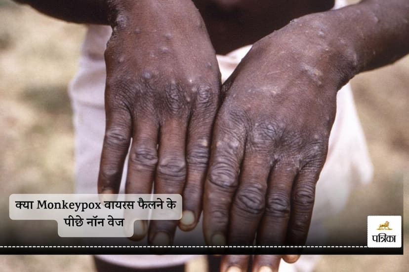 monkeypox