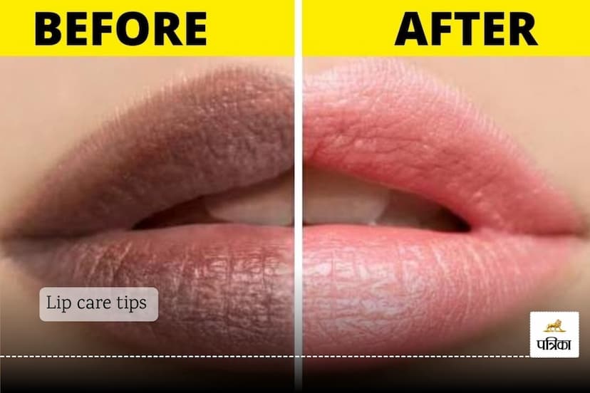 Lip care tips : Your lips deserve the best