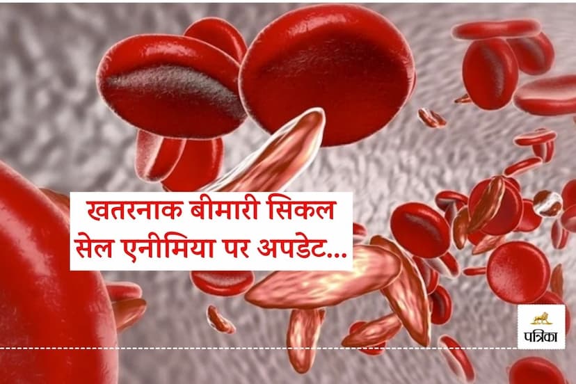 Rajasthan Banswara Sickle Cell Anemia will Now be Controlled Department has Approved 2 Vaccines Administered for Free