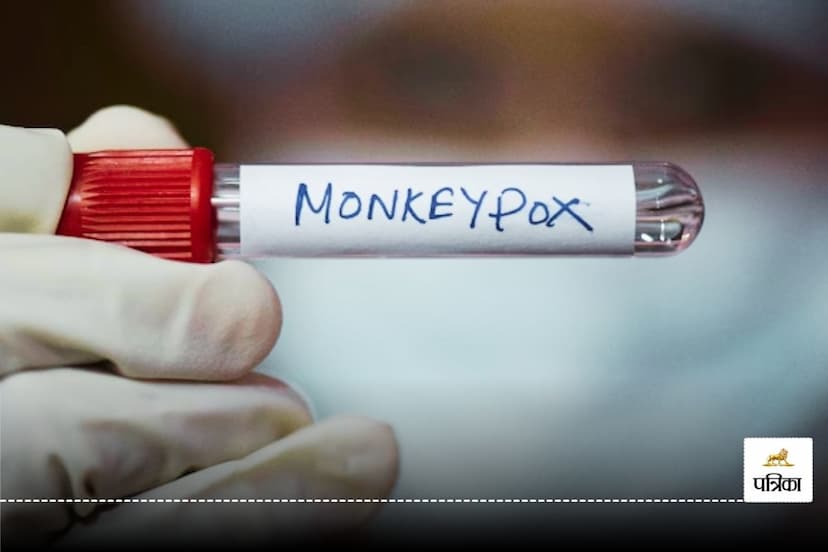 Monkeypox symptoms